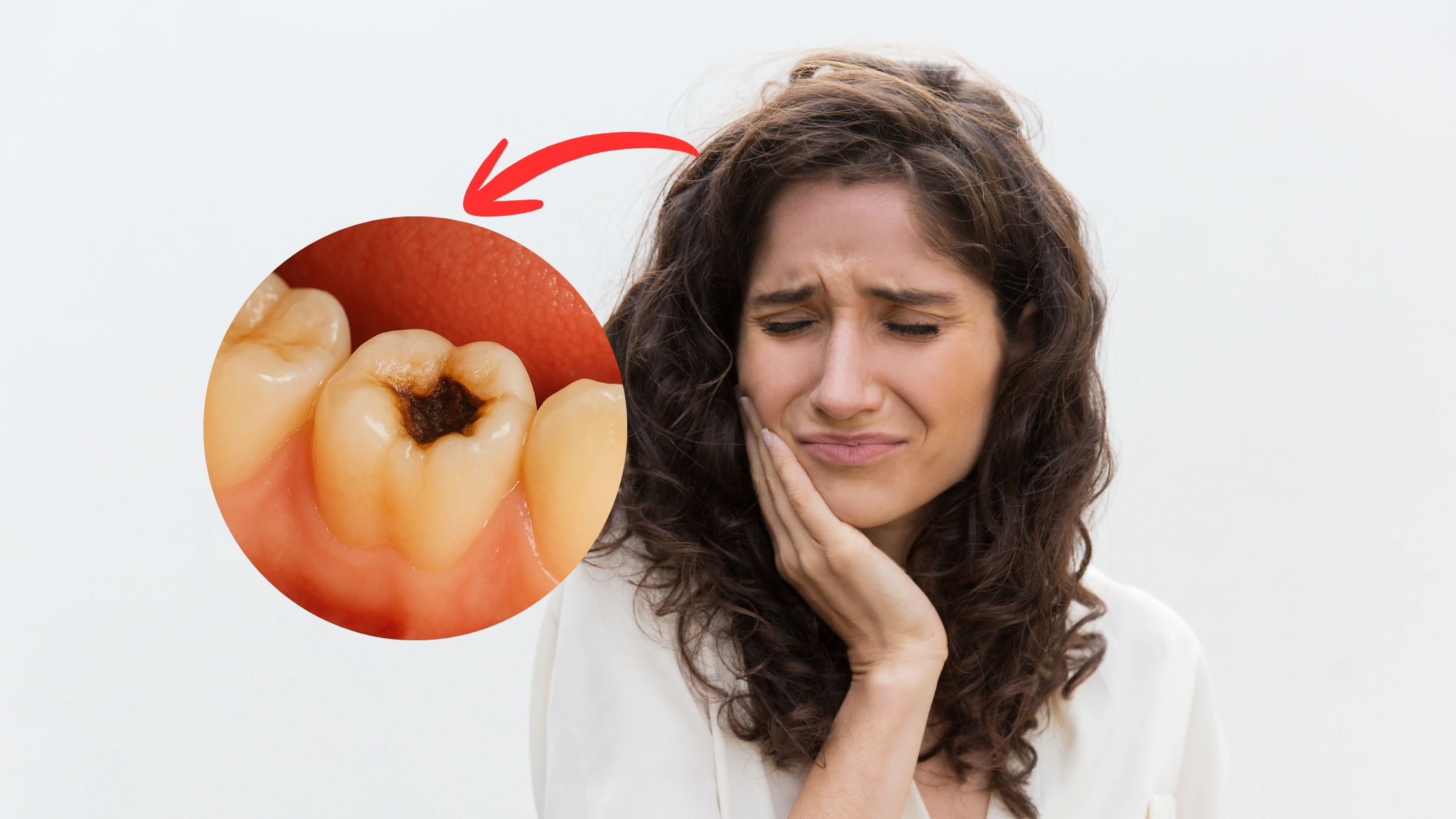 what does a decay tooth look like​